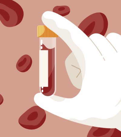 What Can A Blood Test Reveal About Your Hormones?