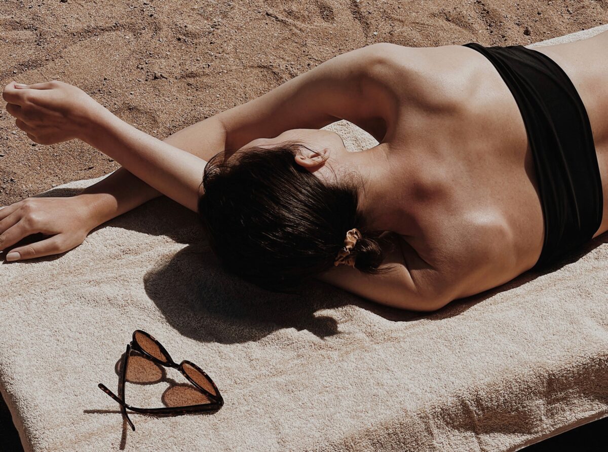 What To Do When… You Accidentally Get Sunburned