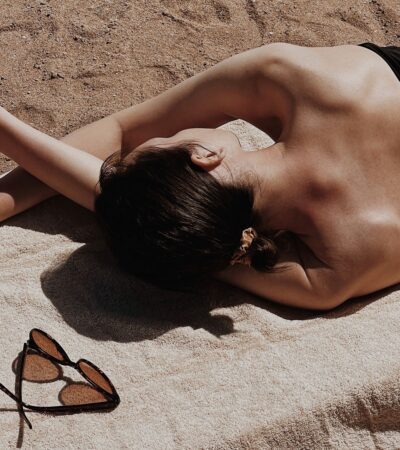 What To Do When… You Accidentally Get Sunburned