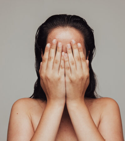 What To Do When… You’ve Reacted to New Skincare