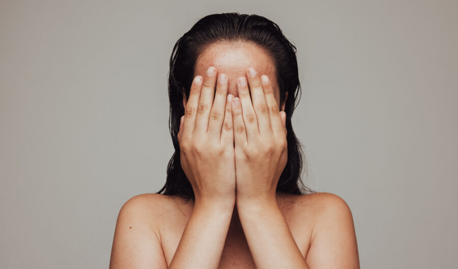 What To Do When… You’ve Reacted to New Skincare