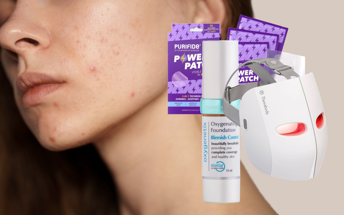 What To Do When… You Wake Up With A Massive Breakout